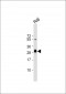 HLA-DPB1 Antibody (Center)